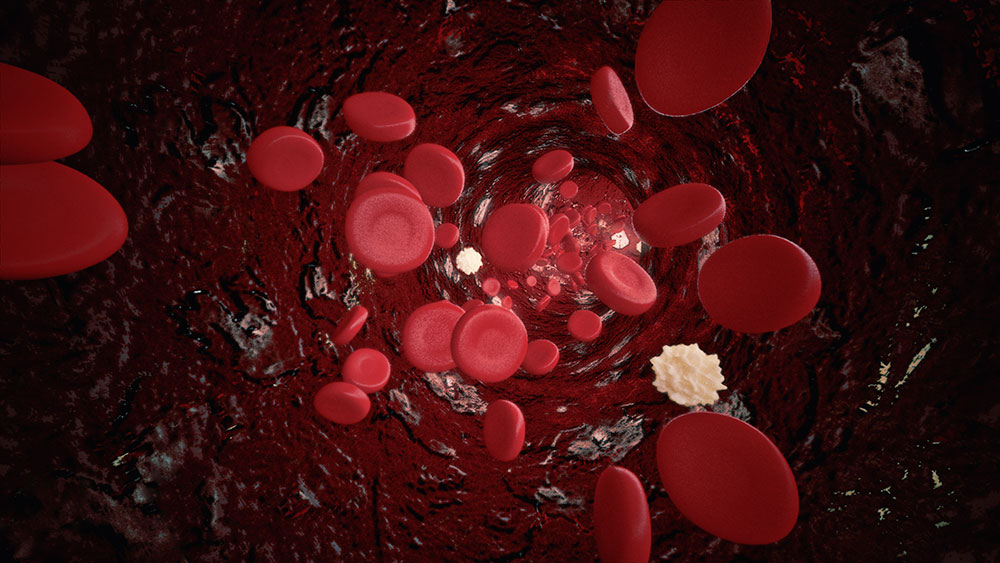 This image has an empty alt attribute; its file name is 13545370_MotionElements_white-and-red-blood-cells.jpg